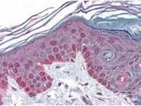 Валидация AssayVector ARM1742(2112)