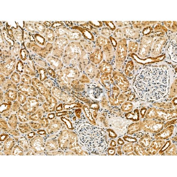 Валидация Affinity DF13218 - 8237