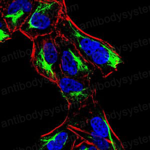 Валидация IF - AntibodySystem RHD31004