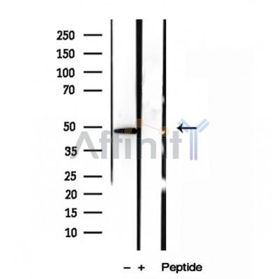 Валидация Affinity DF12019 - 6032