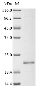 SDS-PAGE