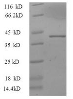 SDS-PAGE