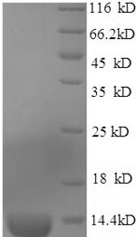SDS-PAGE