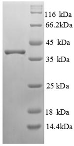 SDS-PAGE