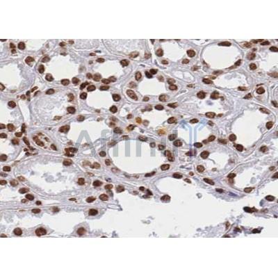 Валидация Affinity AF5276 - 2802