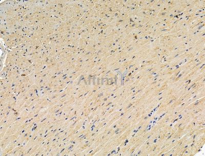 Валидация Affinity DF15116 - 11364