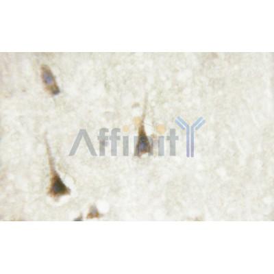 Валидация Affinity AF6257 - 3504