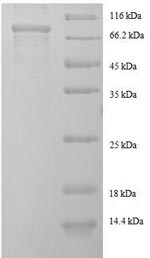 SDS-PAGE