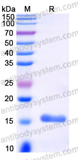 YHJ52902, SDS-PAGE