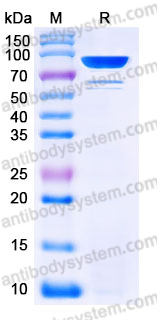 YHE34302, SDS-PAGE