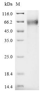 SDS-PAGE