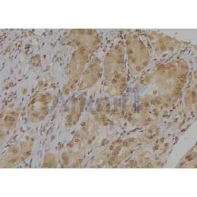 Валидация Affinity DF6551 - 17989