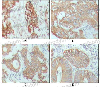 Валидация AntibodySystem RHC17802