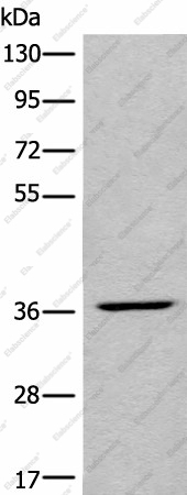 Вестерн-блоттинг, LDAH, клетки HEPG2