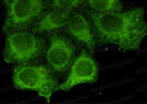 Валидация IF - AntibodySystem RHC17805