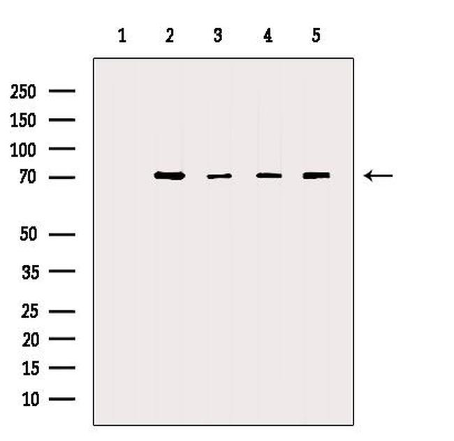Валидация AssayVector ARM2416(4265)