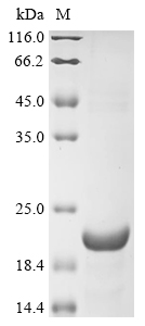 SDS-PAGE