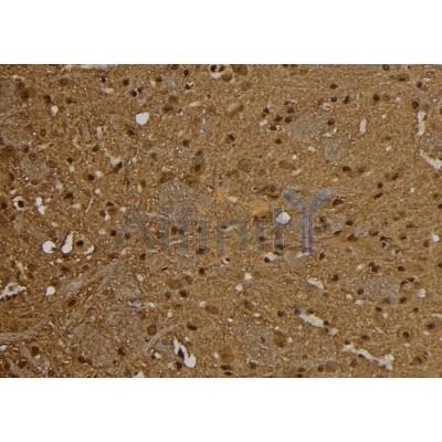 Валидация Affinity DF7298 - 18979