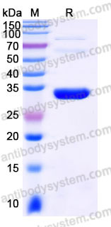 EHC07401, SDS-PAGE