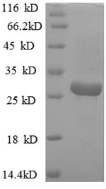 SDS-PAGE