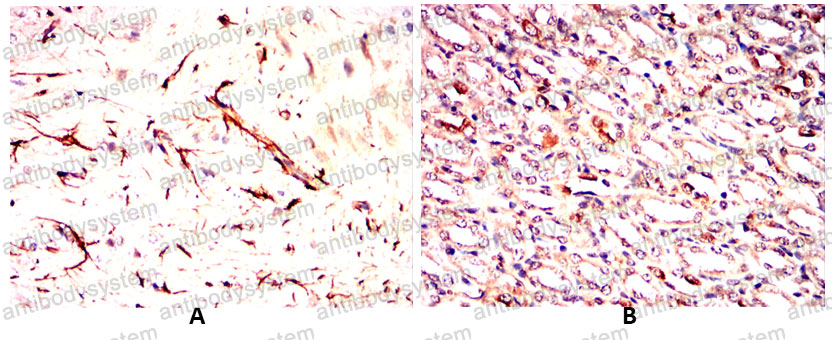 Валидация AntibodySystem RHA30301 (94)