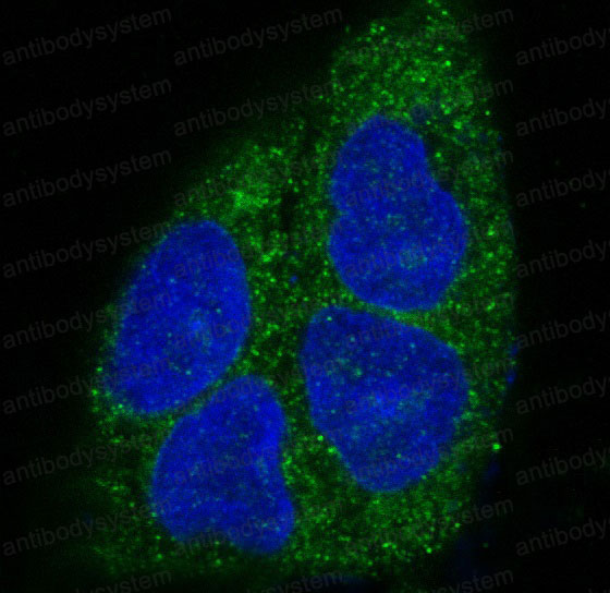 Валидация IF - AntibodySystem RHJ47401
