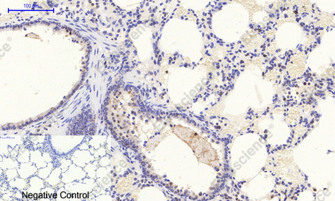 Иммуногистохимия, Phospho-Stat1 (Tyr701), ткань легкого крысы