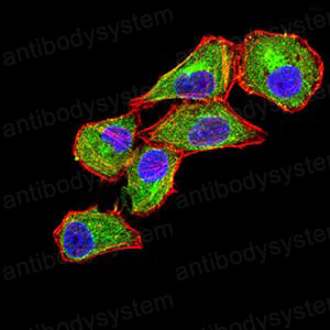 Валидация IF - AntibodySystem RHJ95202