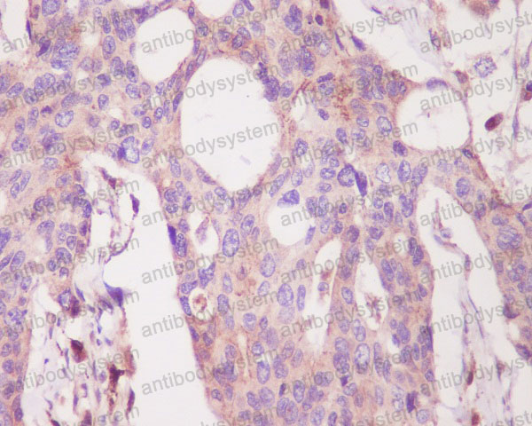 Валидация AntibodySystem RHD23201