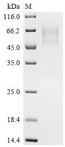 SDS-PAGE