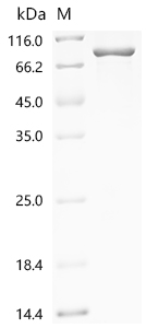 SDS-PAGE