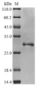 SDS-PAGE