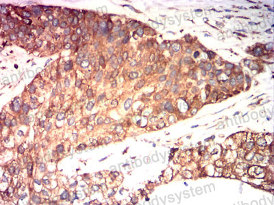 Валидация AntibodySystem RHC24104 (813)