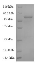 SDS-PAGE