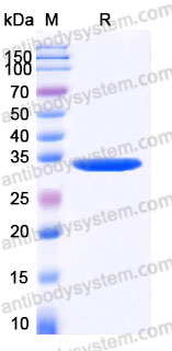 YHA05202, SDS-PAGE