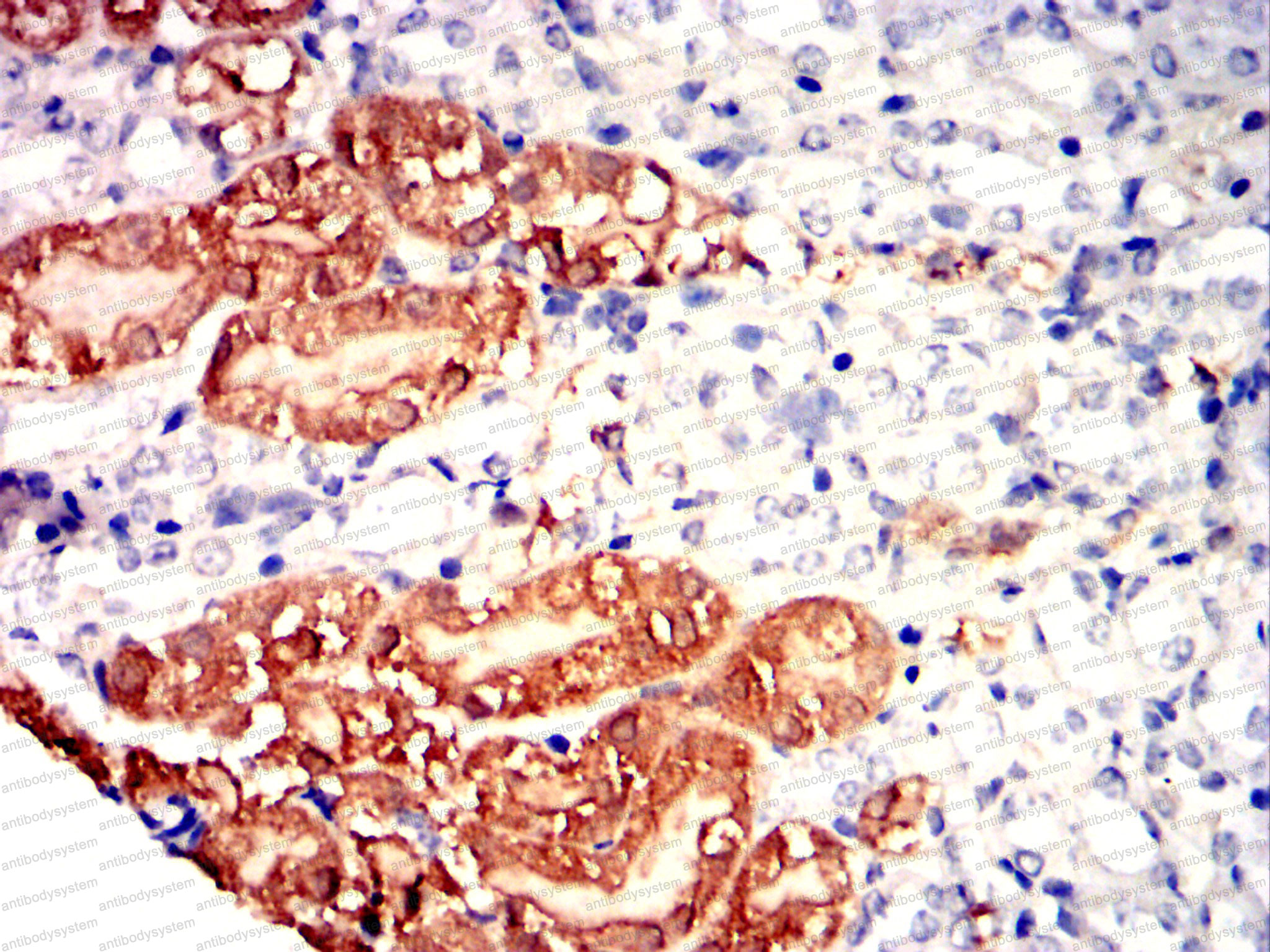 Валидация AntibodySystem RHE94902 (2407)