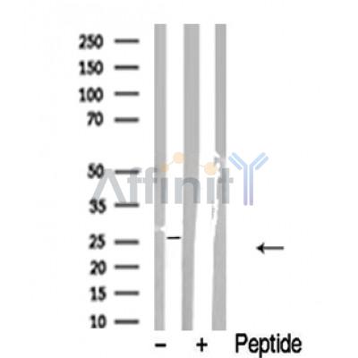 Валидация Affinity AF4649 - 2261