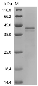 SDS-PAGE