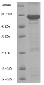 SDS-PAGE