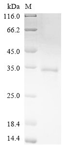 SDS-PAGE