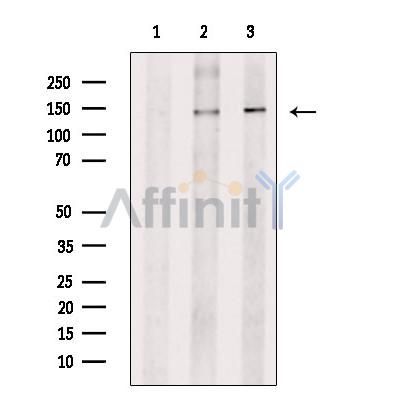 Валидация Affinity AF5200 - 2651