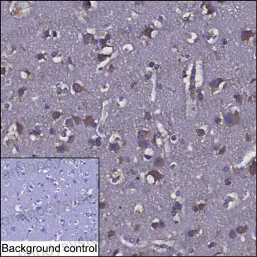 Валидация AntibodySystem RHP02501