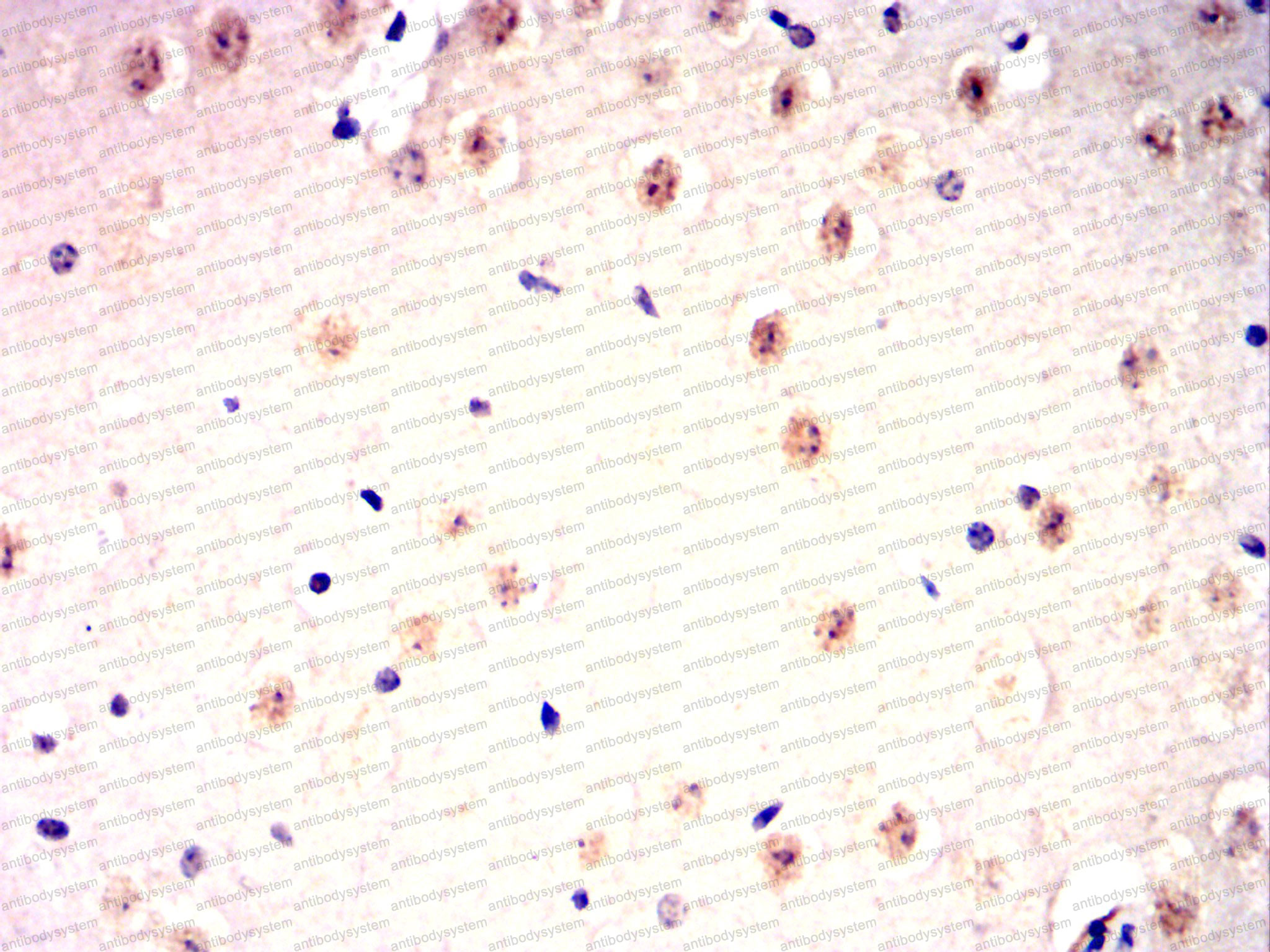 Валидация AntibodySystem RHJ44804 (3421)