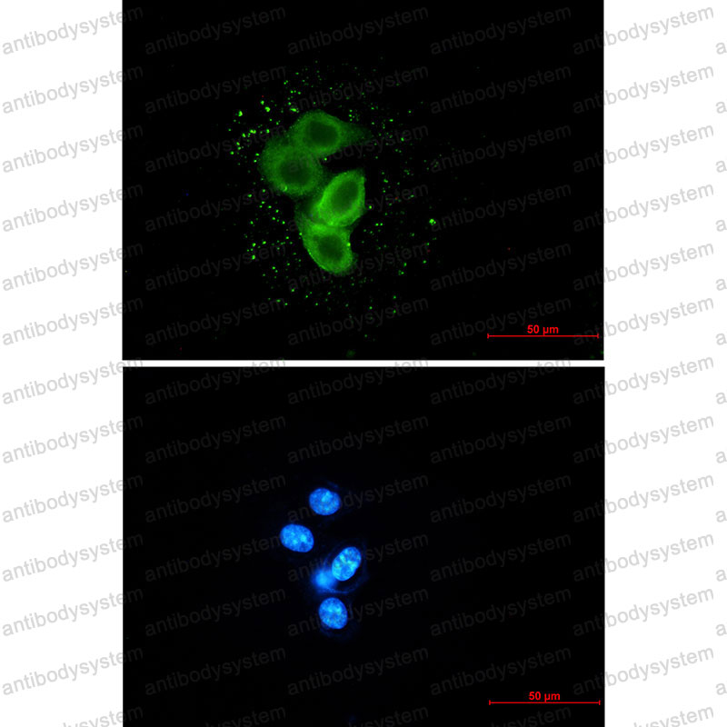 Валидация IF - AntibodySystem RHN66401