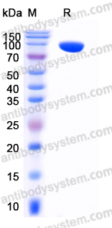 AHD84003, SDS-PAGE