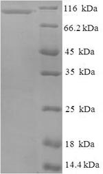 SDS-PAGE