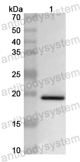 Валидация AntibodySystem PHB46901