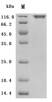 SDS-PAGE