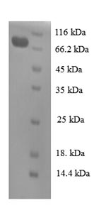 SDS-PAGE