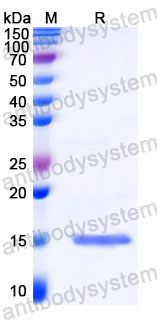Валидация SDS-PAGE - AntibodySystem RZZ01823